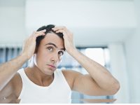 Male Pattern Baldness
